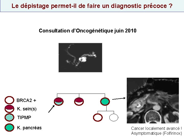 Le dépistage permet-il de faire un diagnostic précoce ? Consultation d’Oncogénétique juin 2010 BRCA