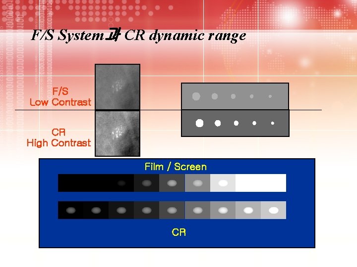 F/S System과 CR dynamic range F/S Low Contrast CR High Contrast Film / Screen