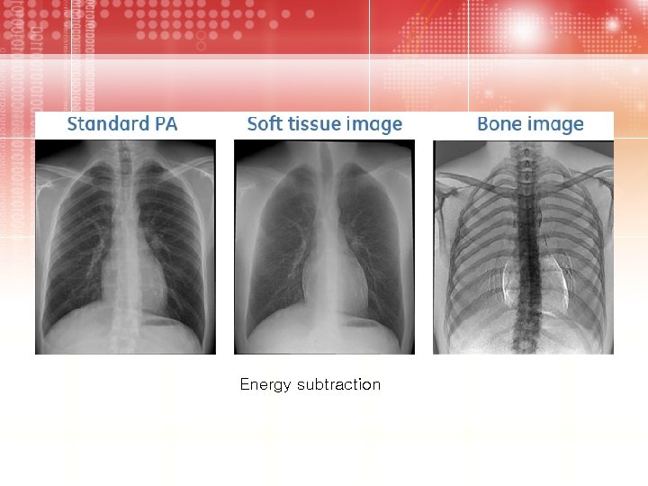 Energy subtraction 