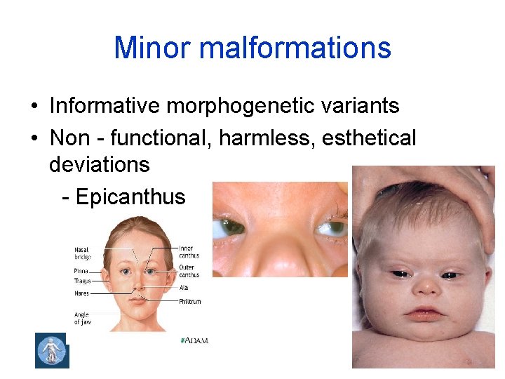 Minor malformations • Informative morphogenetic variants • Non - functional, harmless, esthetical deviations -