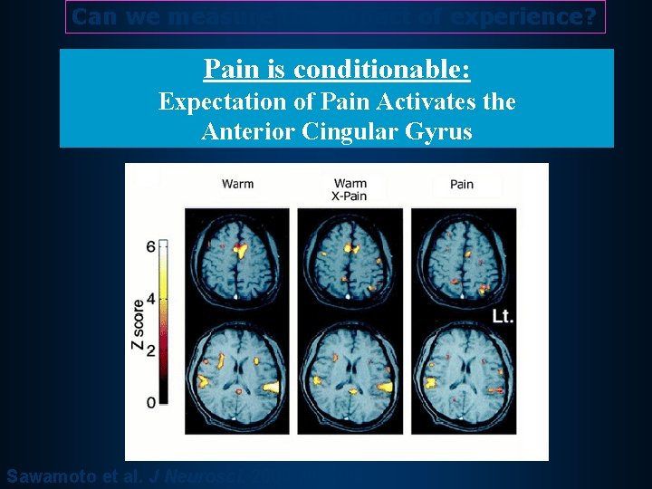 Can we measure the impact of experience? Pain is conditionable: Expectation of Pain Activates