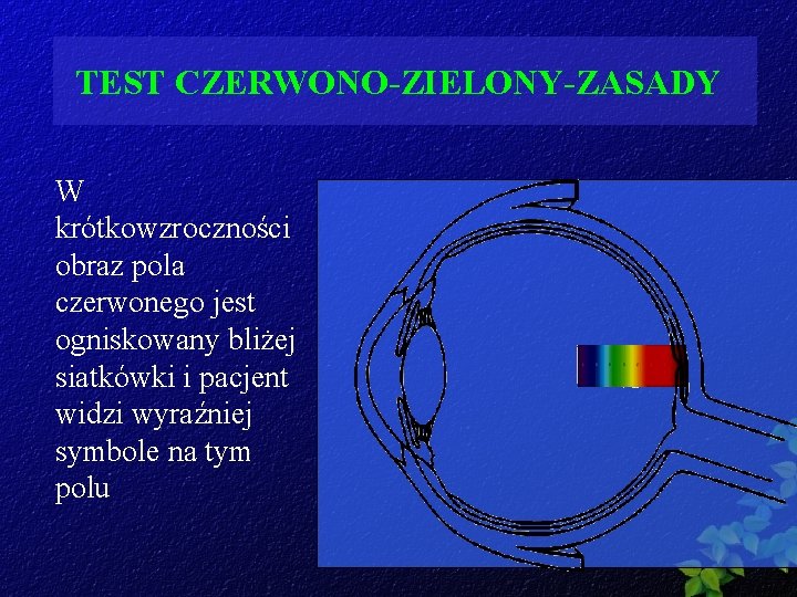 TEST CZERWONO-ZIELONY-ZASADY W krótkowzroczności obraz pola czerwonego jest ogniskowany bliżej siatkówki i pacjent widzi