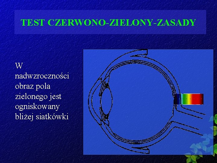 TEST CZERWONO-ZIELONY-ZASADY W nadwzroczności obraz pola zielonego jest ogniskowany bliżej siatkówki 
