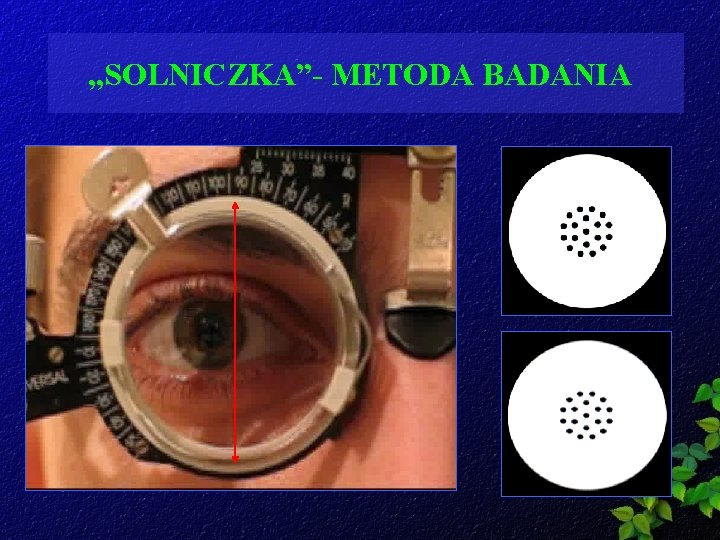 OPTYKA OKULAROWA METODY KOREKCJI WAD WZROKU OSTRO WZROKU