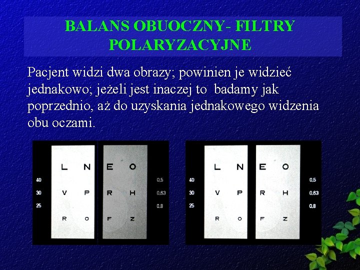 BALANS OBUOCZNY- FILTRY POLARYZACYJNE Pacjent widzi dwa obrazy; powinien je widzieć jednakowo; jeżeli jest