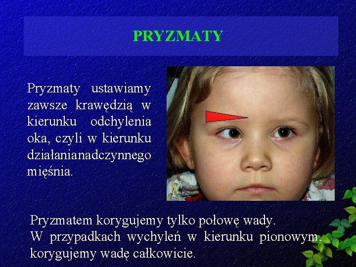 PRYZMATY Pryzmaty ustawiamy zawsze krawędzią w kierunku odchylenia oka, czyli w kierunku działania nadczynnego