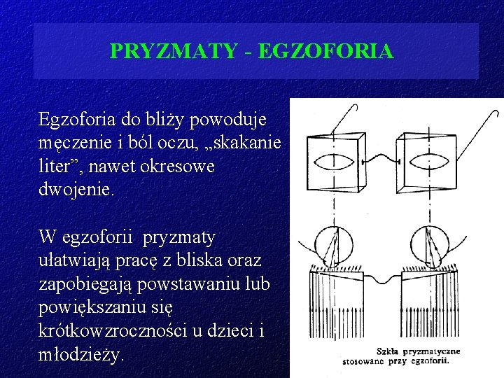 PRYZMATY - EGZOFORIA Egzoforia do bliży powoduje męczenie i ból oczu, „skakanie liter”, nawet