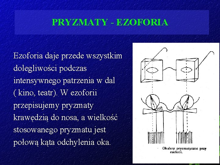 PRYZMATY - EZOFORIA Ezoforia daje przede wszystkim dolegliwości podczas intensywnego patrzenia w dal (