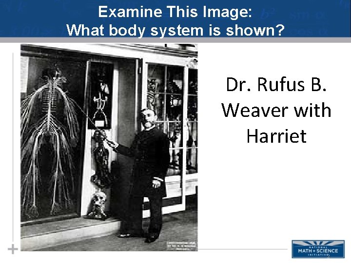 Examine This Image: What body system is shown? Dr. Rufus B. Weaver with Harriet