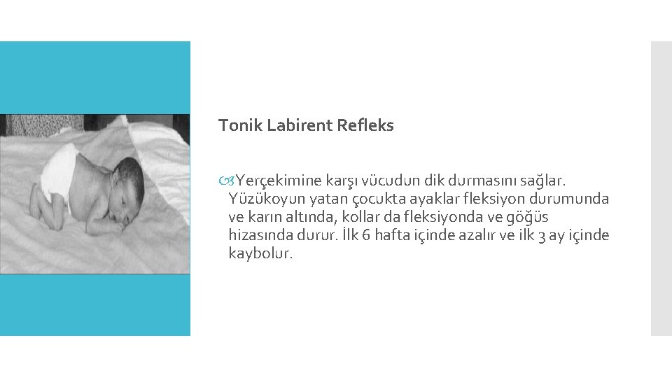 Tonik Labirent Refleks Yerçekimine karşı vücudun dik durmasını sağlar. Yüzükoyun yatan çocukta ayaklar fleksiyon