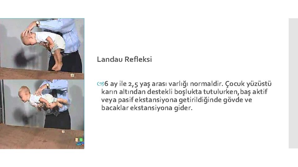 Landau Refleksi 6 ay ile 2, 5 yaş arası varlığı normaldir. Çocuk yüzüstü karın