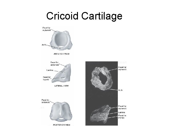 Cricoid Cartilage 