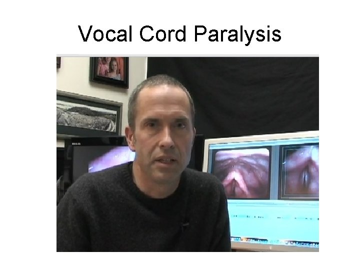 Vocal Cord Paralysis 