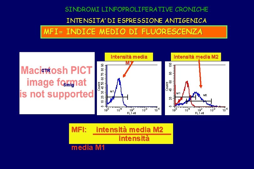 SINDROMI LINFOPROLIFERATIVE CRONICHE INTENSITA’ DI ESPRESSIONE ANTIGENICA MFI= INDICE MEDIO DI FLUORESCENZA Intensità media