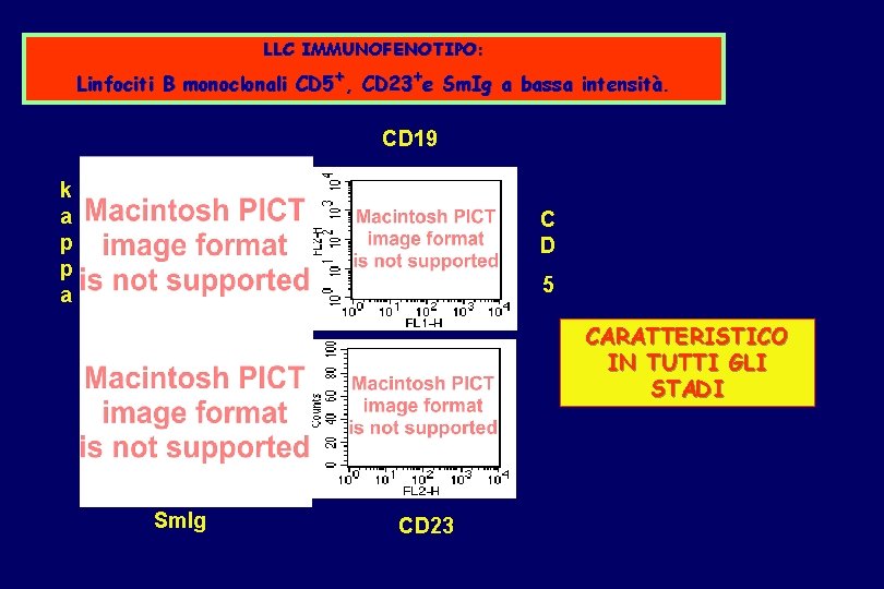 LLC IMMUNOFENOTIPO: Linfociti B monoclonali CD 5+, CD 23+e Sm. Ig a bassa intensità.