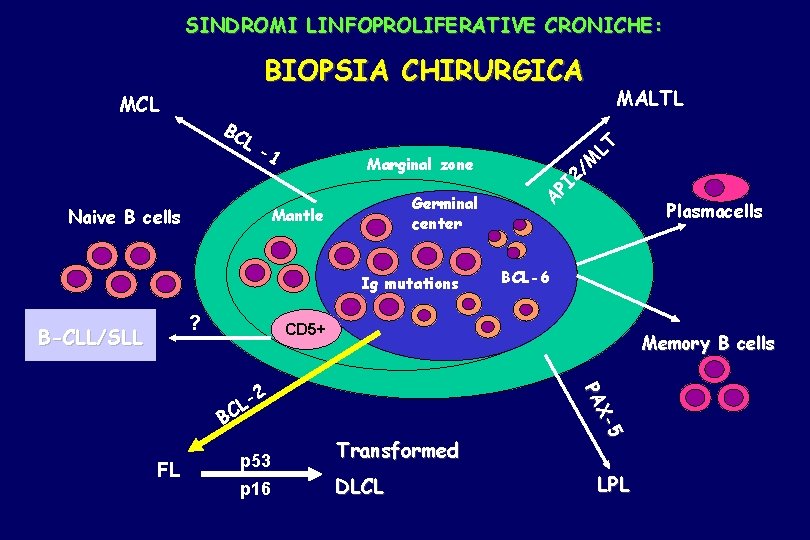 SINDROMI LINFOPROLIFERATIVE CRONICHE: BIOPSIA CHIRURGICA MCL BC L -1 Naive B cells ? Plasmacells