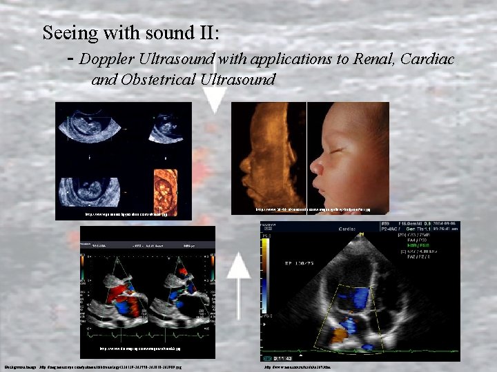 Seeing with sound II: - Doppler Ultrasound with applications to Renal, Cardiac and Obstetrical