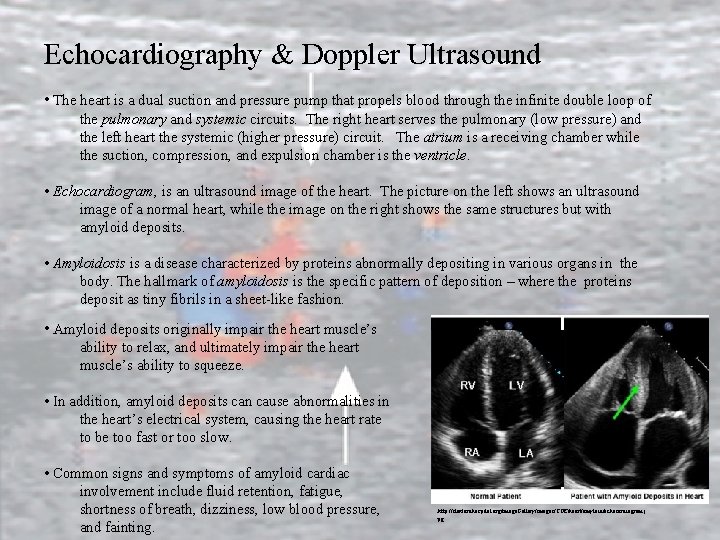 Echocardiography & Doppler Ultrasound • The heart is a dual suction and pressure pump