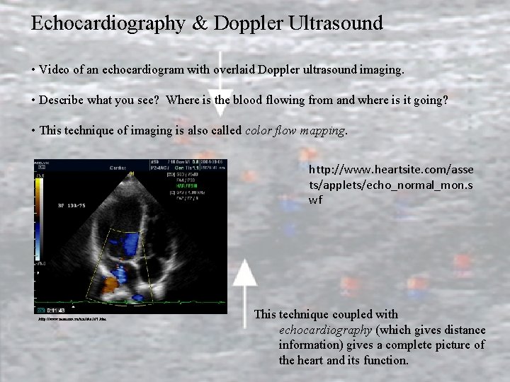 Echocardiography & Doppler Ultrasound • Video of an echocardiogram with overlaid Doppler ultrasound imaging.