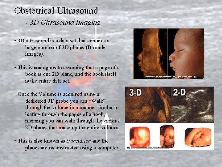 Obstetrical Ultrasound - 3 D Ultrasound Imaging • 3 D ultrasound is a data