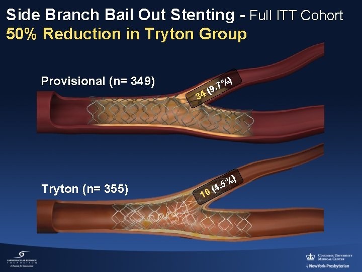 Side Branch Bail Out Stenting - Full ITT Cohort 50% Reduction in Tryton Group