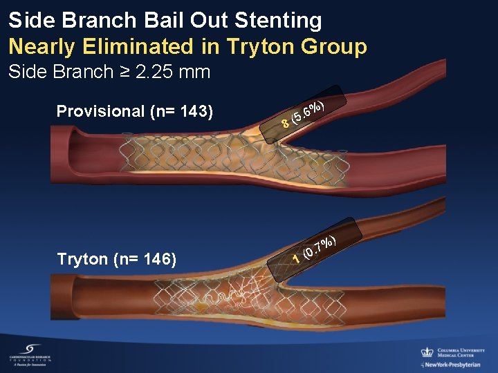 Side Branch Bail Out Stenting Nearly Eliminated in Tryton Group Side Branch ≥ 2.