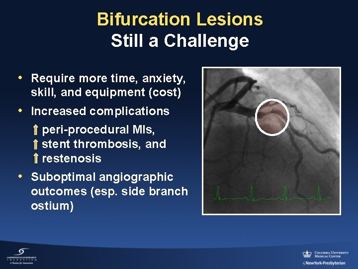 Bifurcation Lesions Still a Challenge • Require more time, anxiety, skill, and equipment (cost)