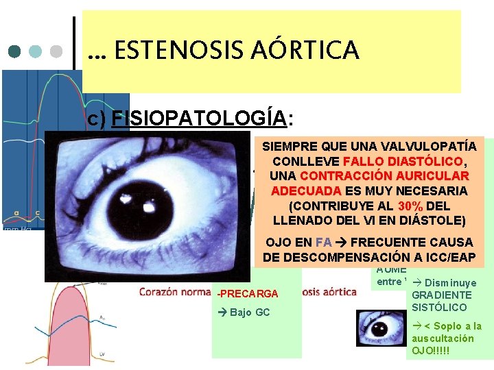 … ESTENOSIS AÓRTICA c) FISIOPATOLOGÍA: SIEMPRE QUE UNA VALVULOPATÍA VI: +POSTCARGA CONLLEVE FALLO DIASTÓLICO,