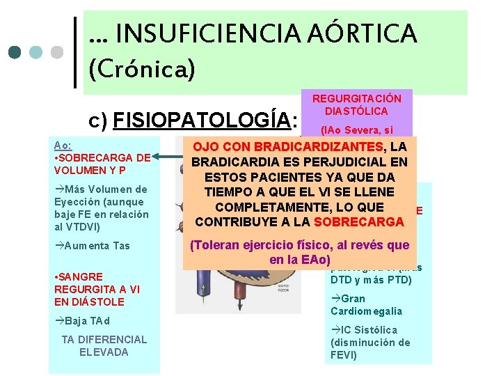 … INSUFICIENCIA AÓRTICA (Crónica) c) FISIOPATOLOGÍA: Ao: • SOBRECARGA DE VOLUMEN Y P Más