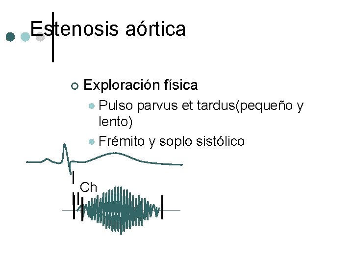 Estenosis aórtica ¢ Exploración física Pulso parvus et tardus(pequeño y lento) l Frémito y