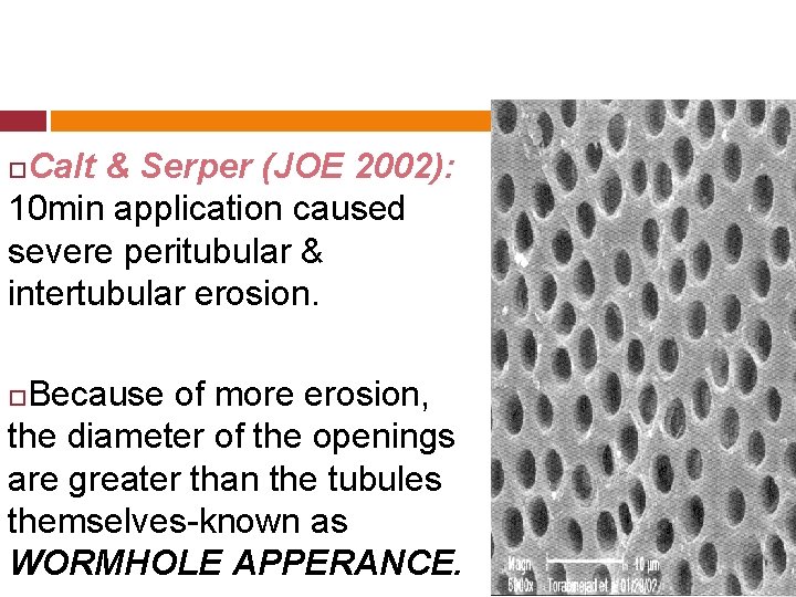 Calt & Serper (JOE 2002): 10 min application caused severe peritubular & intertubular erosion.