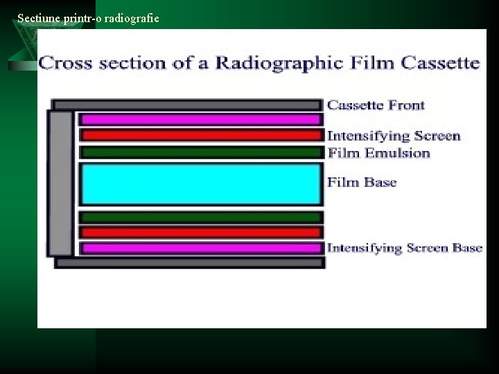 Sectiune printr-o radiografie 