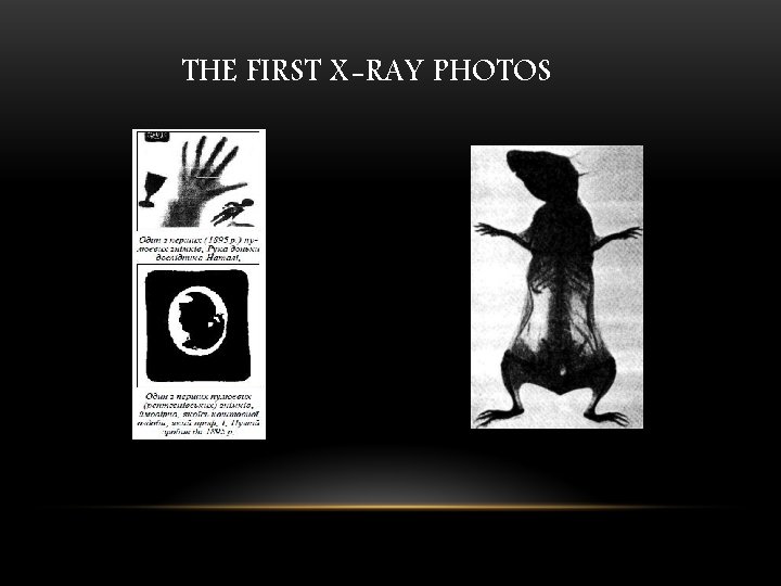 THE FIRST X-RAY PHOTOS 