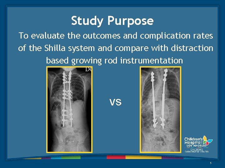 Study Purpose To evaluate the outcomes and complication rates of the Shilla system and