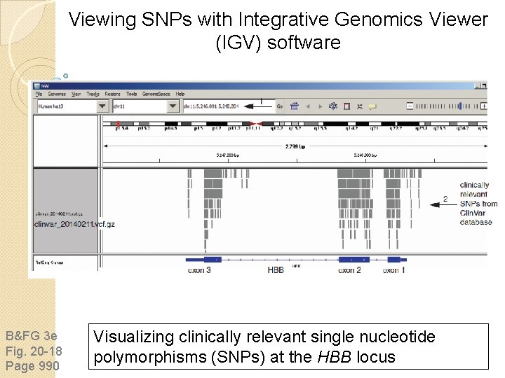 Viewing SNPs with Integrative Genomics Viewer (IGV) software B&FG 3 e Fig. 20 -18 Viewing SNPs with Integrative Genomics Viewer (IGV) software B&FG 3 e Fig. 20 -18