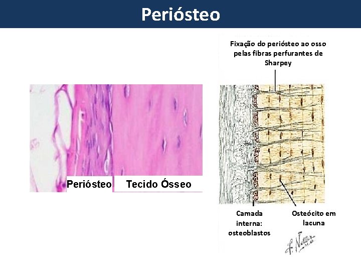Periósteo Fixação do periósteo ao osso pelas fibras perfurantes de Sharpey Periósteo Tecido Ósseo