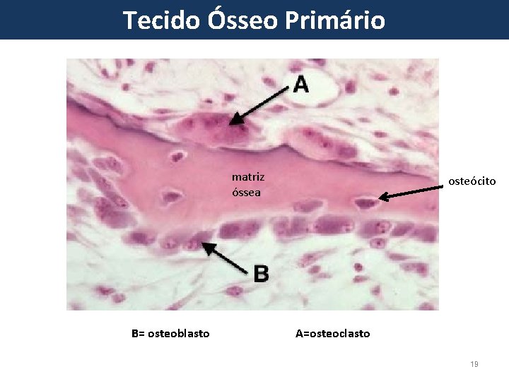 Tecido Ósseo Primário matriz óssea B= osteoblasto osteócito A=osteoclasto 19 
