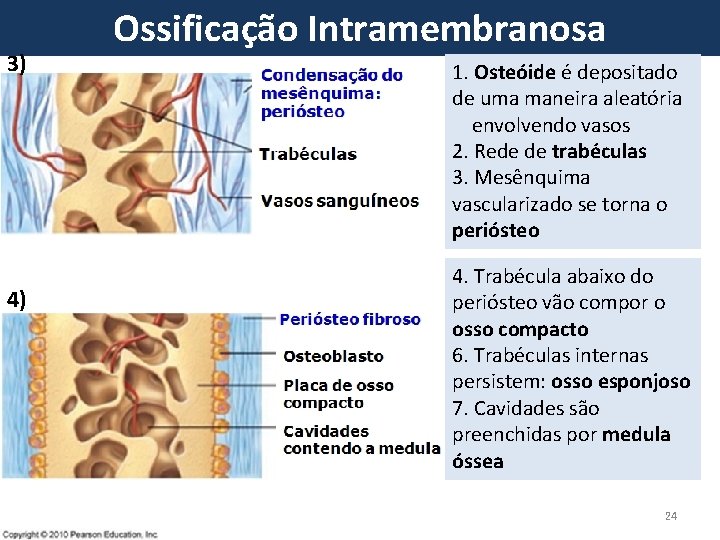 3) 4) Ossificação Intramembranosa 1. Osteóide é depositado de uma maneira aleatória 　 envolvendo