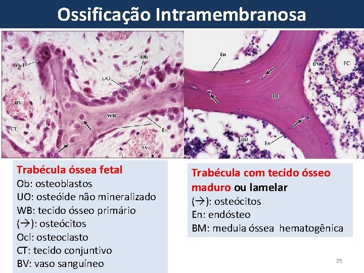 Ossificação Intramembranosa Trabécula óssea fetal Ob: osteoblastos UO: osteóide não mineralizado WB: tecido ósseo