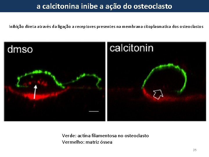 a calcitonina inibe a ação do osteoclasto Inibição direta através da ligação a receptores