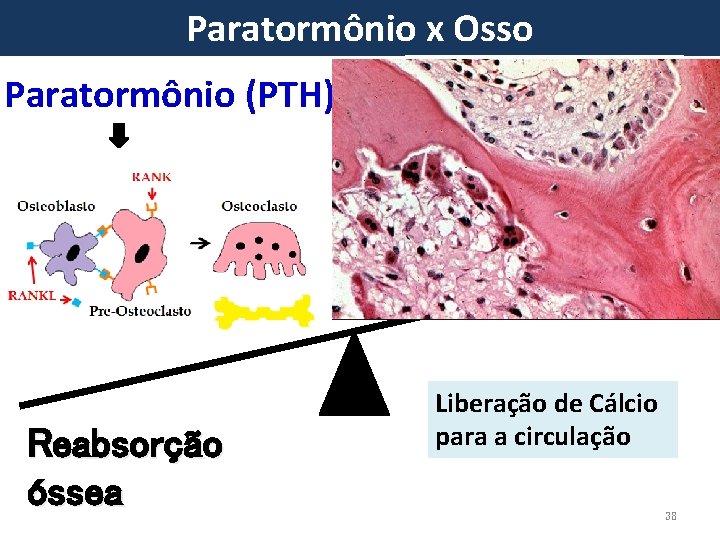 Paratormônio x Osso Paratormônio (PTH) Reabsorção óssea Liberação de Cálcio para a circulação 38