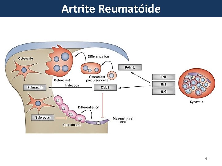 Artrite Reumatóide 41 