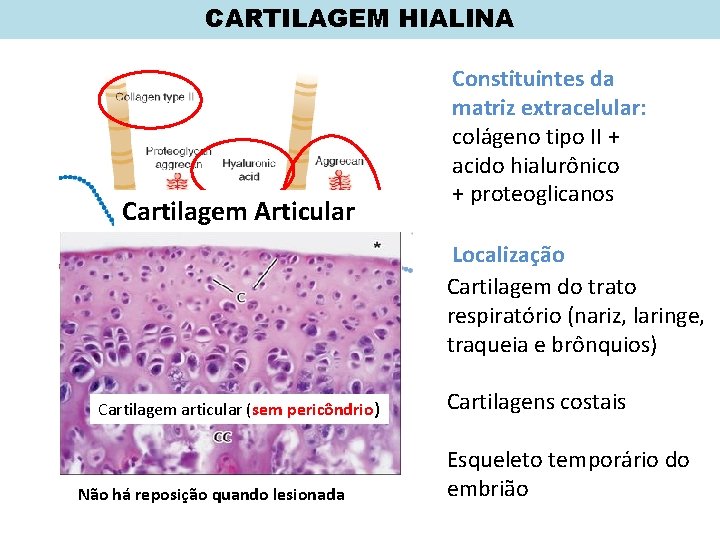 CARTILAGEM HIALINA Cartilagem Articular Constituintes da matriz extracelular: colágeno tipo II + acido hialurônico