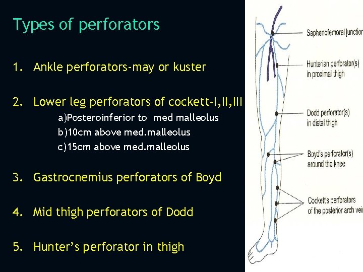 Types of perforators 1. Ankle perforators-may or kuster 2. Lower leg perforators of cockett-I,