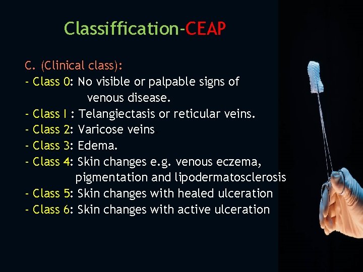 Classiffication-CEAP C. (Clinical class): - Class 0: No visible or palpable signs of venous