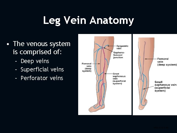 Leg Vein Anatomy • The venous system is comprised of: – Deep veins –
