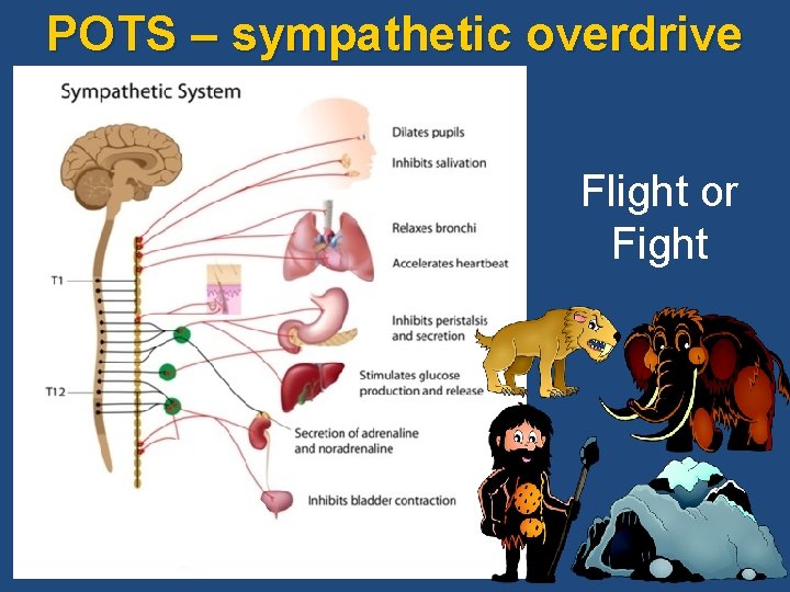 POTS – sympathetic overdrive Flight or Fight 