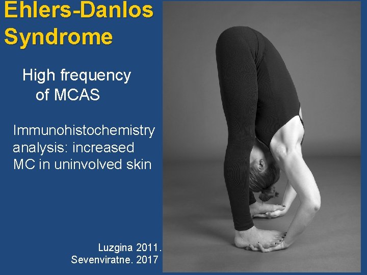 Ehlers-Danlos Syndrome High frequency of MCAS Immunohistochemistry analysis: increased MC in uninvolved skin Luzgina