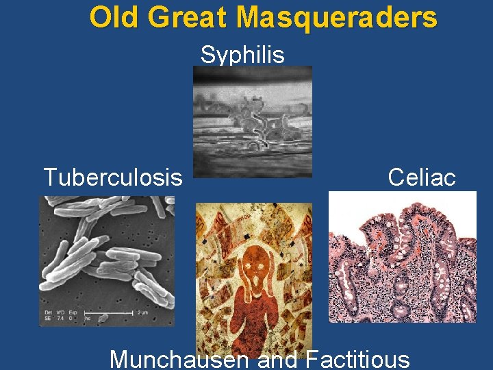 Old Great Masqueraders Syphilis Tuberculosis Celiac Munchausen and Factitious 