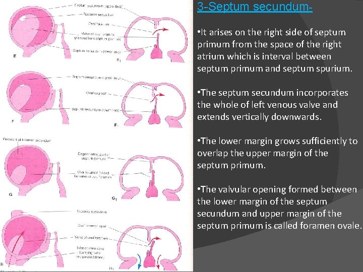 3 -Septum secundum • It arises on the right side of septum primum from